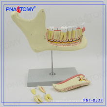 Modelo de osso PNT-0537gc direto dentes de fábrica e modelo de mandíbula